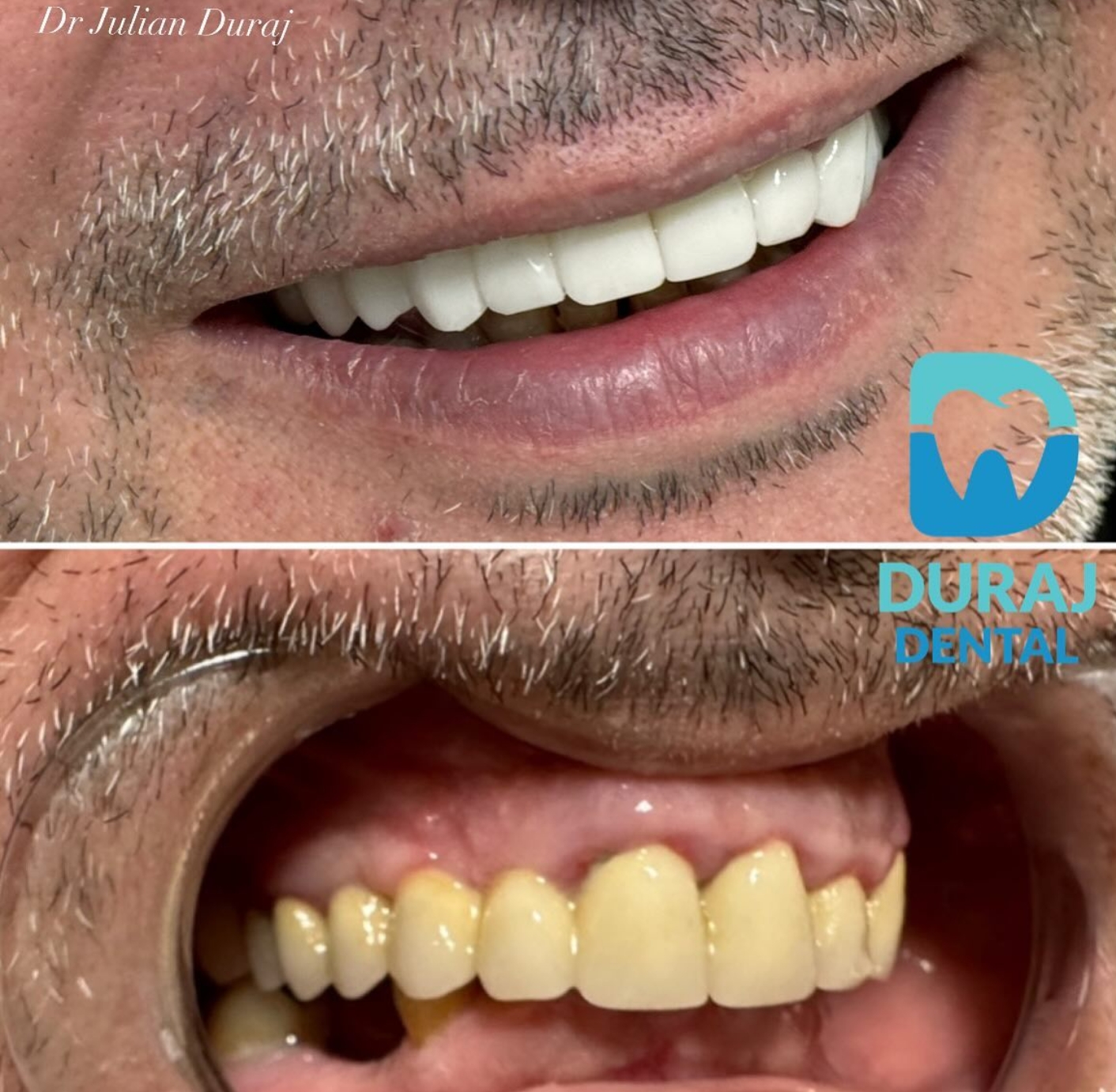 Patient smile transformation 5